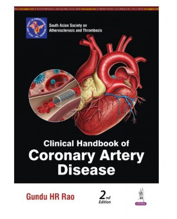 Clinical Handbook of Coronary Artery Disease for Cardiologists and DM/DNB Postgraduates;2nd Edition 2027 by Gundu HR Rao