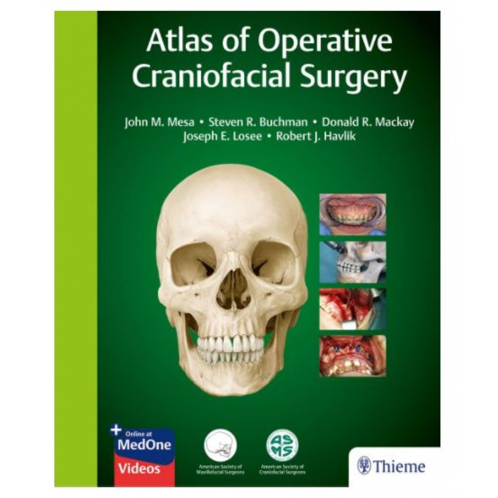 Atlas of Operative Craniofacial Surgery;1st Edition 2019 By John M. Mesa, Steven R. Buchman, Donald R. Mackay & Joseph E. Losee