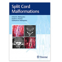 Split Cord Malformations;1st Edition 2021 By Ashok K.Mahapatra, Sachin A. Borkar & Subhashree Mahapatra