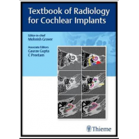 Textbook of Radiology for Cochlear Implants;1st Edition 2022 By Mohnish Grover & Gaurav Gupta