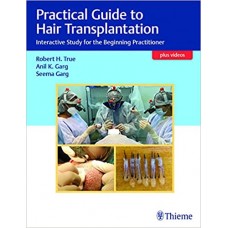 Practical Guide to Hair Transplantation;1st edition 2021 by Robert True