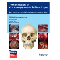 100 Complications of Otorhinolaryngology & Skull Base Surgery;1st Edition 2023 by Veerasigamani Narendrakumar