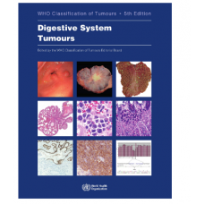 WHO's Classification of Tumours:Digestive System Tumours; 5th Edition 2019 by World Health Organization