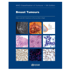 WHO's Classification of Tumours: Breast Tumours; 5th Edition 2019 by World Health Organization