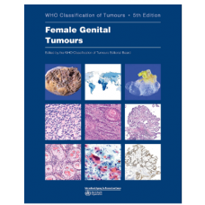 WHO's Classification of Tumours: Female Genital Tumours; 5th Edition 2020 by World Health Organization