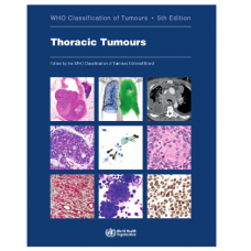 WHO's Classification of Tumours:Thoracic Tumours(Volume 5); 5th Edition 2021 by World Health Organization