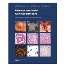 WHO's Classification of Tumours: Urinary and Male Genital Tumours; 5th Edition 2022 by World Health Organization