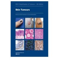 WHO Classification of Tumours: Skin Tumours;5th Edition 2025 by WHO Editorial board