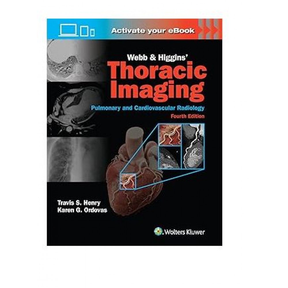 Webb and Higgins Thoracic Imaging (Pulmonary and Cardiovascular Radiology);4th Edition 2025 by Travis Scott Henry & Karen Gomes Ordovas