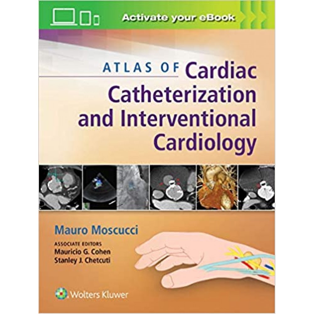 Atlas of Cardiac Catheterization and Interventional Cardiology;1st Edition 2018 By Mauro Moscucci