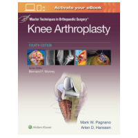 Master Techniques in Orthopaedic Surgery: Knee Arthroplasty;4th Edition 2018 By Pagnanao M W
