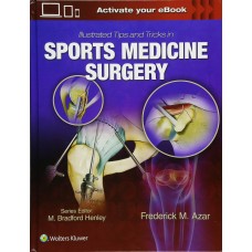 Illustrated Tips and Tricks in Sports Medicine Surgery;1st Edition 2018 by Frederick M. Azar