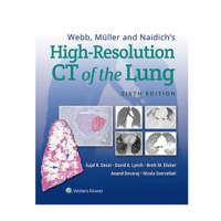 Webb, Müller and Naidich's High-Resolution CT of the Lung; 6th Edition 2021 By Sujal Desai
