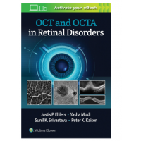 Oct And Octa In Retinal Disorders (With Access Code);1st Edition 2021 By Ehlers J P