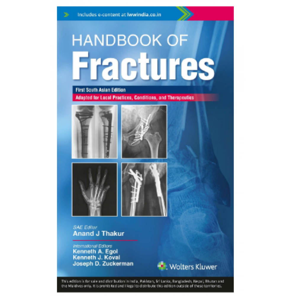 Handbook of Fractures;1st(South Asia) Edition 2022 By Anand J.Thakur & Kenneth J. Koval