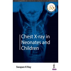 Chest X-ray in Neonates and Children;1st Edition 2019 By Swapan K Ray