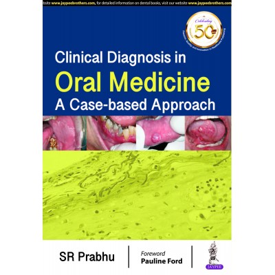 Clinical Diagnosis in Oral Medicine: A Case-based Approach;1st Edition 2019 By SR Prabhu