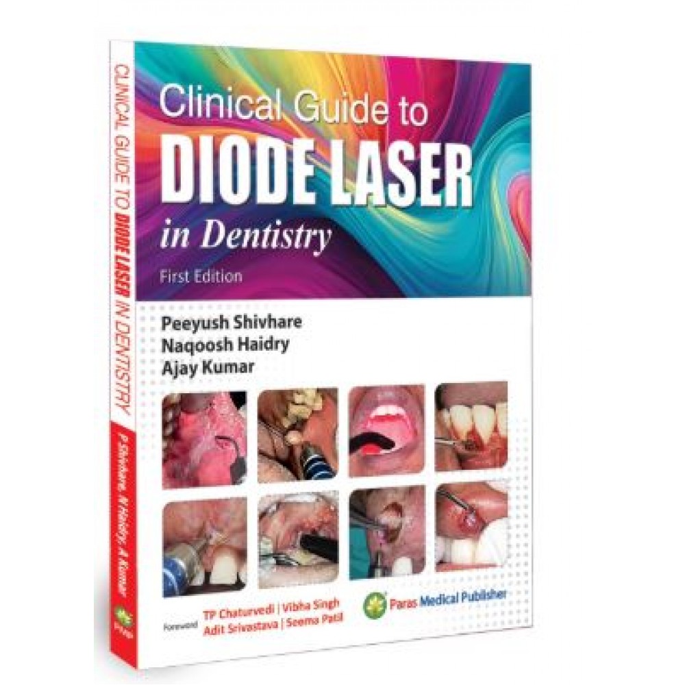 Clinical Guide to Diode Laser in Dentistry;1st Edition 2026 by Peeyush Shivhare, Naqoosh Haidry & Ajay Kumar
