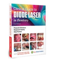 Clinical Guide to Diode Laser in Dentistry;1st Edition 2026 by Peeyush Shivhare, Naqoosh Haidry & Ajay Kumar