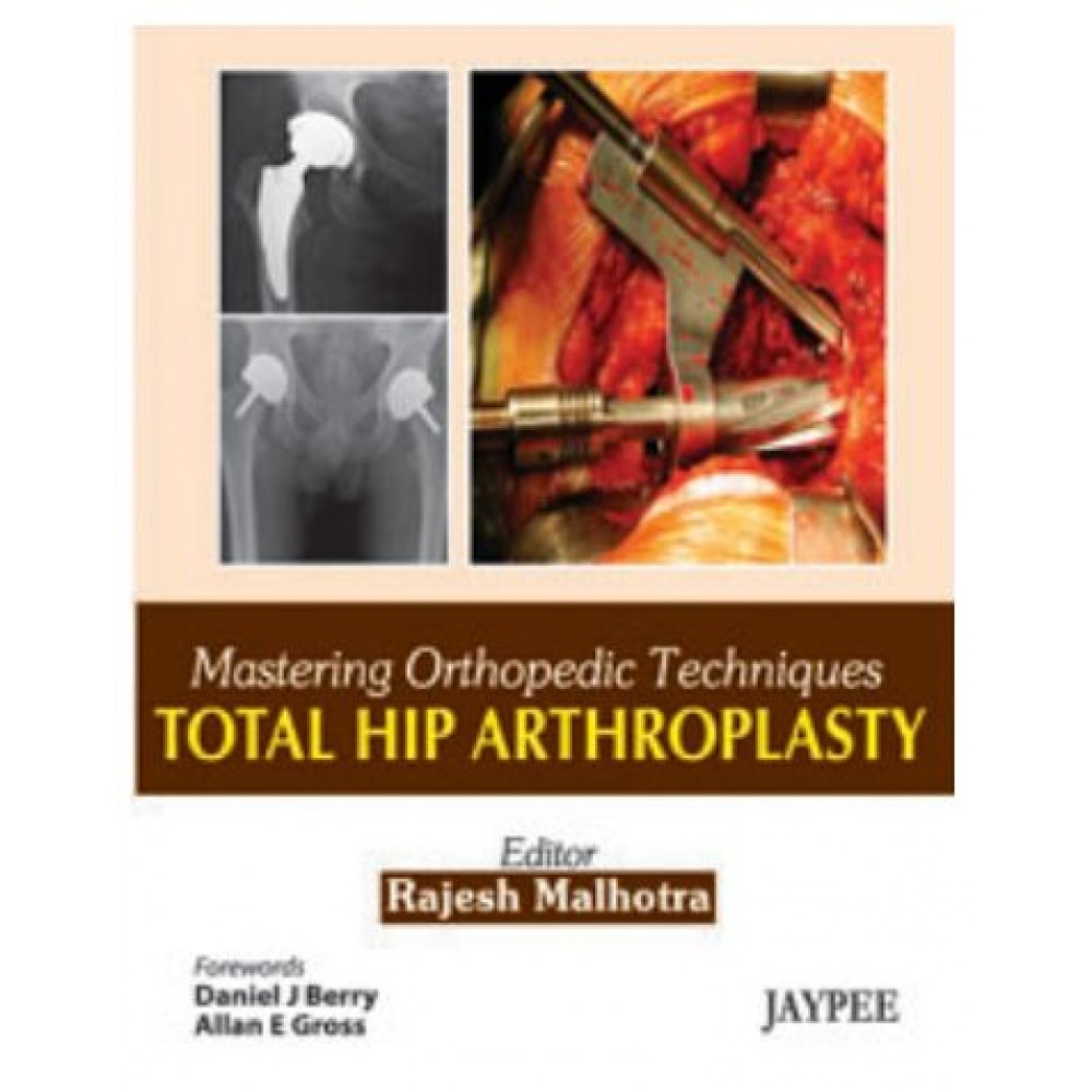 Mastering Orthopedic Techniques Total Hip Arthroplasty;1st(Reprint) Edition 2025 by Rajesh Malhotra