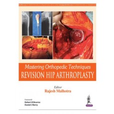 Mastering Orthopedic Techniques Revision Hip Arthroplasty;1st Edition 2017 by Rajesh Malhotra