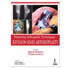 Mastering Orthopedic Techniques:Revision Knee Arthroplasty;1st(Reprint) Edition 2025 by Rajesh Malhotra & Deepak Gautam