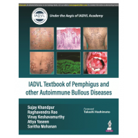 IADVL Textbook of Pemphigus and Other Autoimmune Bullous Diseases;1st Edition 2024 By Sujay Khandpur