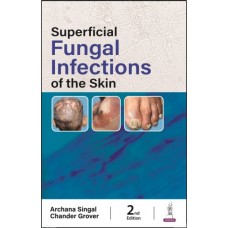 Superficial Fungal Infections of the Skin:2nd Edition 2024 By Archana Singal