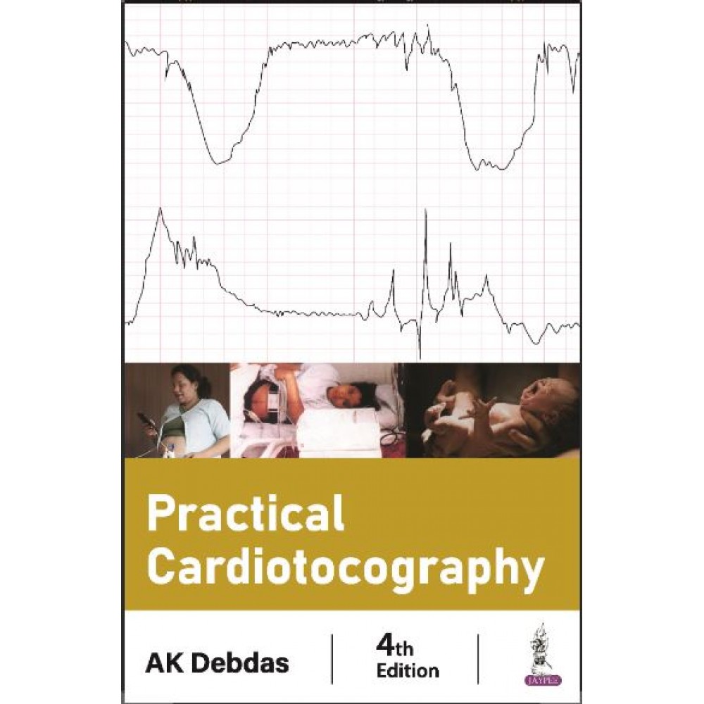 Practical Cardiotocography:4th Edition 2024 By AK Debdas