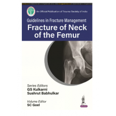 Guidelines in Fracture Management Fracture of Neck of the Femur;1st Edition 2024 By GS Kulkarni
