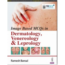 Image Based Mcqs In Dermatology  Venereology & Leprology:1st Edition 2024 By Ramesh Bansal