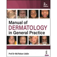 Manual of Dermatology in General Practice:2nd Edition 2024 By Prof Dr Md Rokon Uddin