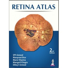 Retina Atlas:2nd Edition 2024 By SPS Grewal	& Manpreet Brar	& Mansi Sharma