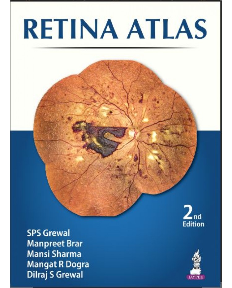 Retina Atlas:2nd Edition 2024 By SPS Grewal	& Manpreet Brar	& Mansi Sharma