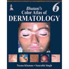 Bhutani’s Color Atlas of Dermatology;6th Edition 2015 By Neena Khanna & Saurabh Singh