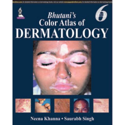 Bhutani’s Color Atlas of Dermatology;6th Edition 2015 By Neena Khanna & Saurabh Singh