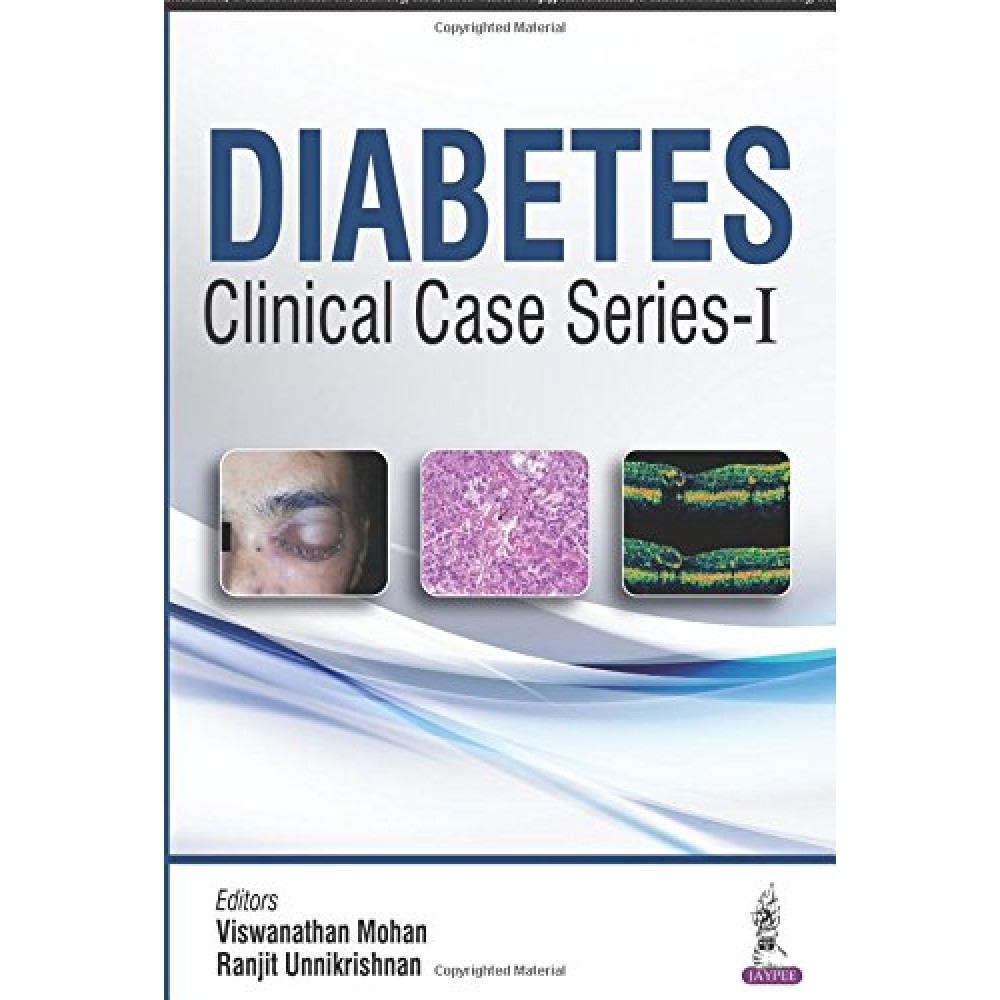 Diabetes Clinical Case (Series-I);1st Edition 2016 By Mohan Viswanathan