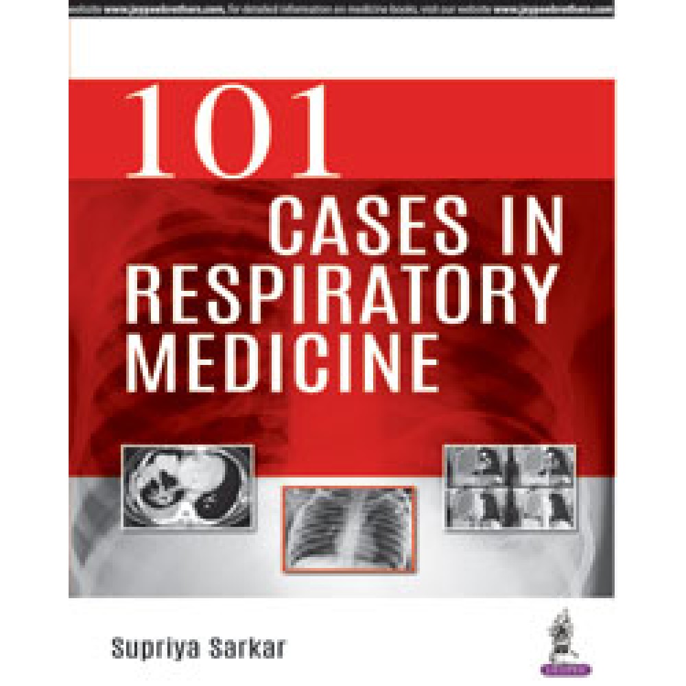 101 Cases in Respiratory Medicine;1st Edition 2018 By Supriya Sarkar 101 Cases in Respiratory Medicine;1st Edition 2018 By Supriya Sarkar