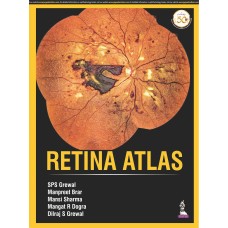 Retina Atlas;1st Edition 2020 by SPS Grewal