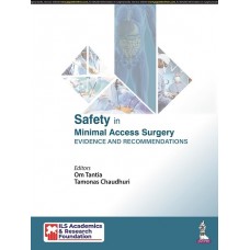 Safety in Minimal Access Surgery Evidence and Recommendations;1st Edition 2021 by Om Tantia,Tamonas Chaudhuri