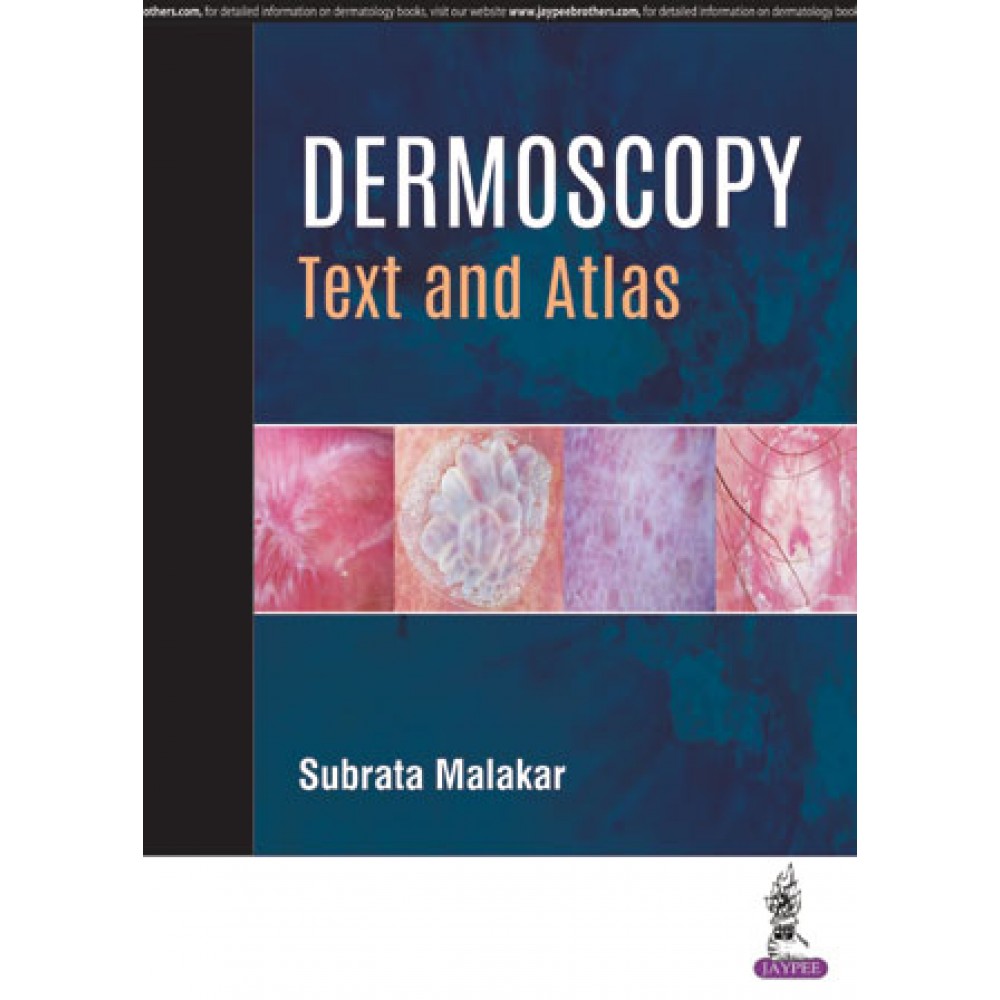 Dermoscopy:Text and Atlas;1st Edition 2019 By Subrata Malakar Priya Diwaker