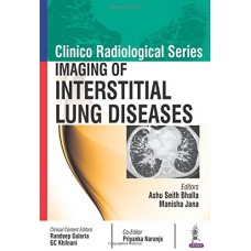 Clinico Radiological Series Imaging of Interstitial Lung Diseases;1st Edition 2017 By Ashu Seith bhalla & Manisha Jana 