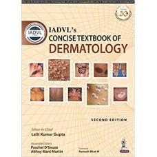 IADVL’s Concise Textbook Of Dermatology;2nd Edition 2019 By lalit Kumar Gupta
