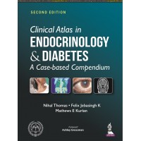 Clinical Atlas in Endocrinology & Diabetes;2nd Edition 2022 By Nihal Thomas, Mathews E Kurian & Felix Jebasingh K