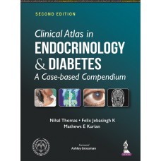 Clinical Atlas in Endocrinology & Diabetes;2nd Edition 2022 By Nihal Thomas, Mathews E Kurian & Felix Jebasingh K