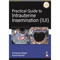 Practical Guide to Intrauterine Insemination;1st Edition 2021 by Chaitanya Nagori & Sonal Panchal