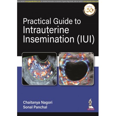 Practical Guide to Intrauterine Insemination;1st Edition 2021 by Chaitanya Nagori & Sonal Panchal