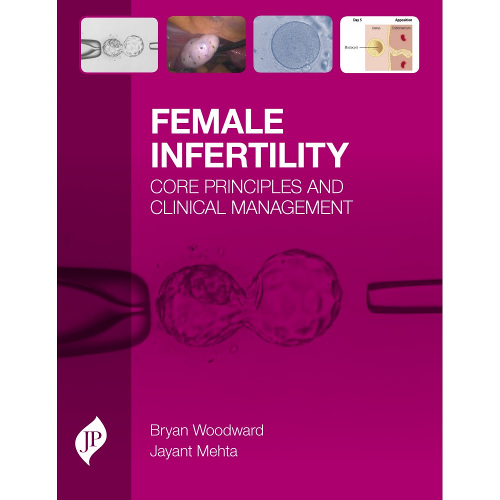 Female Infertility: Core Principles and Clinical Management;1st Edition 2020 by Bryan Woodward & Jayant Mehta