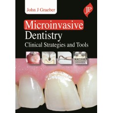 Microinvasive Dentistry: Clinical Strategies and Tools;1st Edition 2021 By John J Graeber