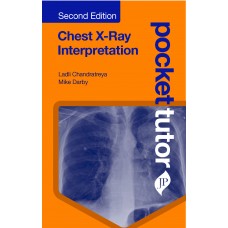 Pocket Tutor:Chest X-Ray Interpretation;2nd Edition 2020 By Ladli Chandratreya,Mike Darby